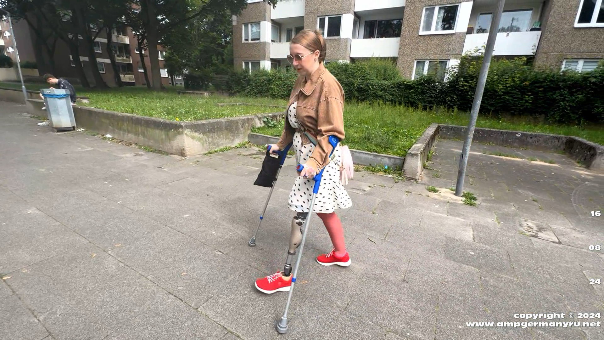 Olena Walking with test prosthesis